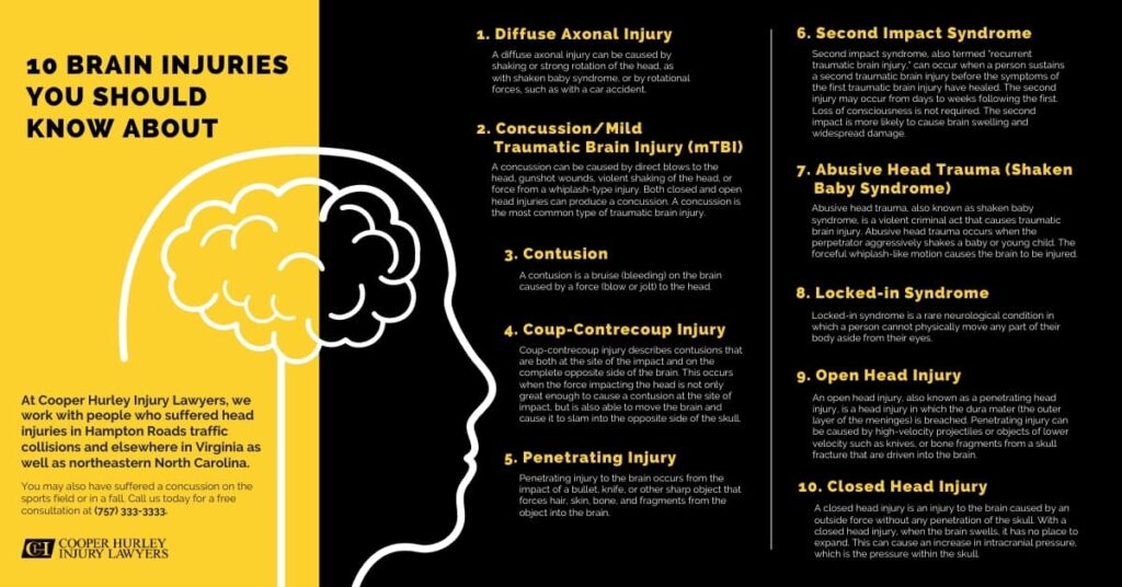 Infographic for "10 Brain Injuries You Should Know About"
